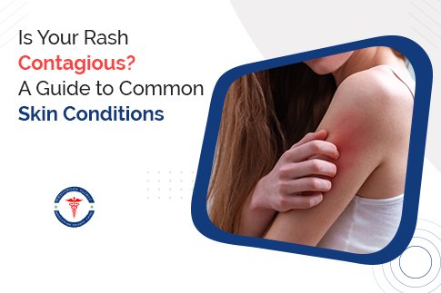 Is Your Rash Contagious? A Guide to Common Skin Conditions