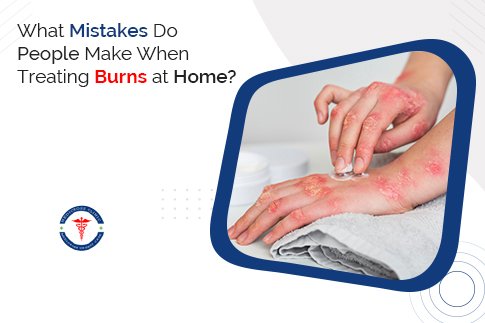 What Mistakes Do People Make When Treating Burns at Home