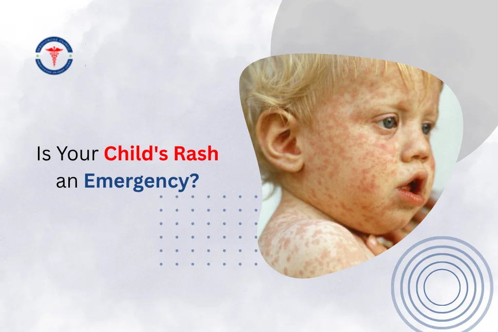 Is Your Child's Rash an Emergency?